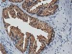 ACAT2 Antibody in Immunohistochemistry (Paraffin) (IHC (P))