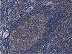 ACAT2 Antibody in Immunohistochemistry (Paraffin) (IHC (P))