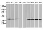 ACAT2 Antibody in Western Blot (WB)