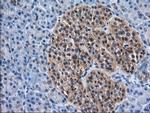 ACAT2 Antibody in Immunohistochemistry (Paraffin) (IHC (P))