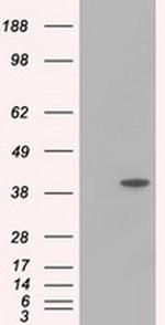 ACAT2 Antibody in Western Blot (WB)