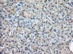 RAB17 Antibody in Immunohistochemistry (Paraffin) (IHC (P))