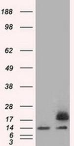 Profilin 1 Antibody in Western Blot (WB)