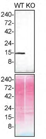 Profilin 1 Antibody in Western Blot (WB)