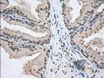 SNX9 Antibody in Immunohistochemistry (Paraffin) (IHC (P))