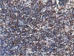 TACC3 Antibody in Immunohistochemistry (Paraffin) (IHC (P))