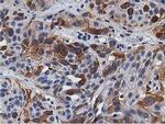 TACC3 Antibody in Immunohistochemistry (Paraffin) (IHC (P))