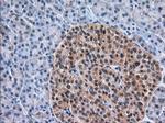 TACC3 Antibody in Immunohistochemistry (Paraffin) (IHC (P))