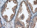 TACC3 Antibody in Immunohistochemistry (Paraffin) (IHC (P))