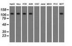 TACC3 Antibody in Western Blot (WB)