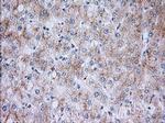 RAB17 Antibody in Immunohistochemistry (Paraffin) (IHC (P))