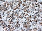 RAB17 Antibody in Immunohistochemistry (Paraffin) (IHC (P))