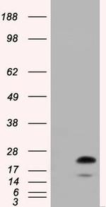 RAB17 Antibody in Western Blot (WB)