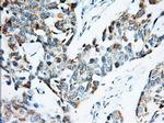 IGF2BP2 Antibody in Immunohistochemistry (Paraffin) (IHC (P))