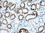 IGF2BP2 Antibody in Immunohistochemistry (Paraffin) (IHC (P))