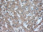 IGF2BP2 Antibody in Immunohistochemistry (Paraffin) (IHC (P))