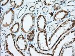 IGF2BP2 Antibody in Immunohistochemistry (Paraffin) (IHC (P))