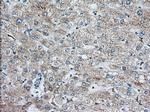 IGF2BP2 Antibody in Immunohistochemistry (Paraffin) (IHC (P))