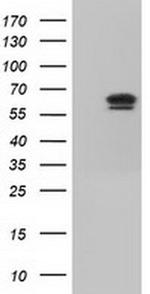 IGF2BP2 Antibody in Western Blot (WB)