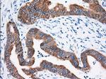 IGF2BP2 Antibody in Immunohistochemistry (Paraffin) (IHC (P))