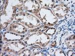 IGF2BP2 Antibody in Immunohistochemistry (Paraffin) (IHC (P))