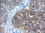 IGF2BP2 Antibody in Immunohistochemistry (Paraffin) (IHC (P))