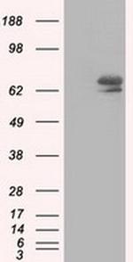 IGF2BP2 Antibody in Western Blot (WB)