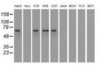 IGF2BP2 Antibody in Western Blot (WB)