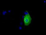 KHK Antibody in Immunocytochemistry (ICC/IF)