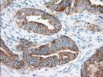 KHK Antibody in Immunohistochemistry (Paraffin) (IHC (P))