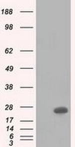 BDH2 Antibody in Western Blot (WB)