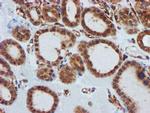 CYB5R3 Antibody in Immunohistochemistry (Paraffin) (IHC (P))