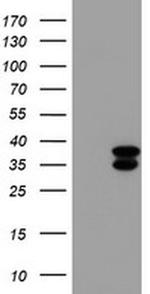 CYB5R3 Antibody in Western Blot (WB)