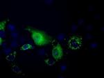 PANK2 Antibody in Immunocytochemistry (ICC/IF)