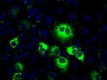 Thromboxane synthase Antibody in Immunocytochemistry (ICC/IF)