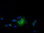 Thromboxane synthase Antibody in Immunocytochemistry (ICC/IF)