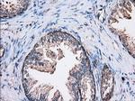 Thromboxane synthase Antibody in Immunohistochemistry (Paraffin) (IHC (P))