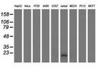 Ephrin A2 Antibody in Western Blot (WB)