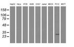 CRYM Antibody in Western Blot (WB)