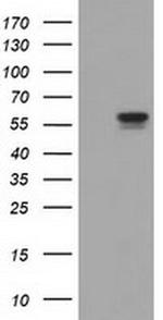 DYNC1LI1 Antibody in Western Blot (WB)