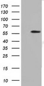 DYNC1LI1 Antibody in Western Blot (WB)