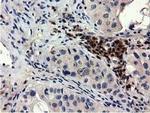 QPRT Antibody in Immunohistochemistry (Paraffin) (IHC (P))