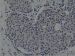 SH3GL1 Antibody in Immunohistochemistry (Paraffin) (IHC (P))