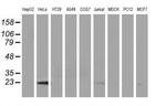 LIN7B Antibody in Western Blot (WB)