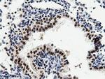 NT5D1 Antibody in Immunohistochemistry (Paraffin) (IHC (P))