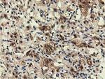 EPHX2 Antibody in Immunohistochemistry (Paraffin) (IHC (P))