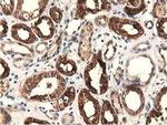 EPHX2 Antibody in Immunohistochemistry (Paraffin) (IHC (P))