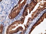 EPHX2 Antibody in Immunohistochemistry (Paraffin) (IHC (P))