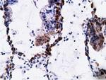 EPHX2 Antibody in Immunohistochemistry (Paraffin) (IHC (P))