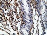 EPHX2 Antibody in Immunohistochemistry (Paraffin) (IHC (P))